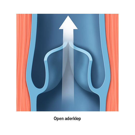 Aderklep open Aderklep open
