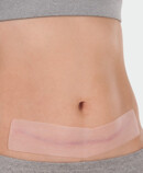 Juzo ScarPad, application on the abdomen