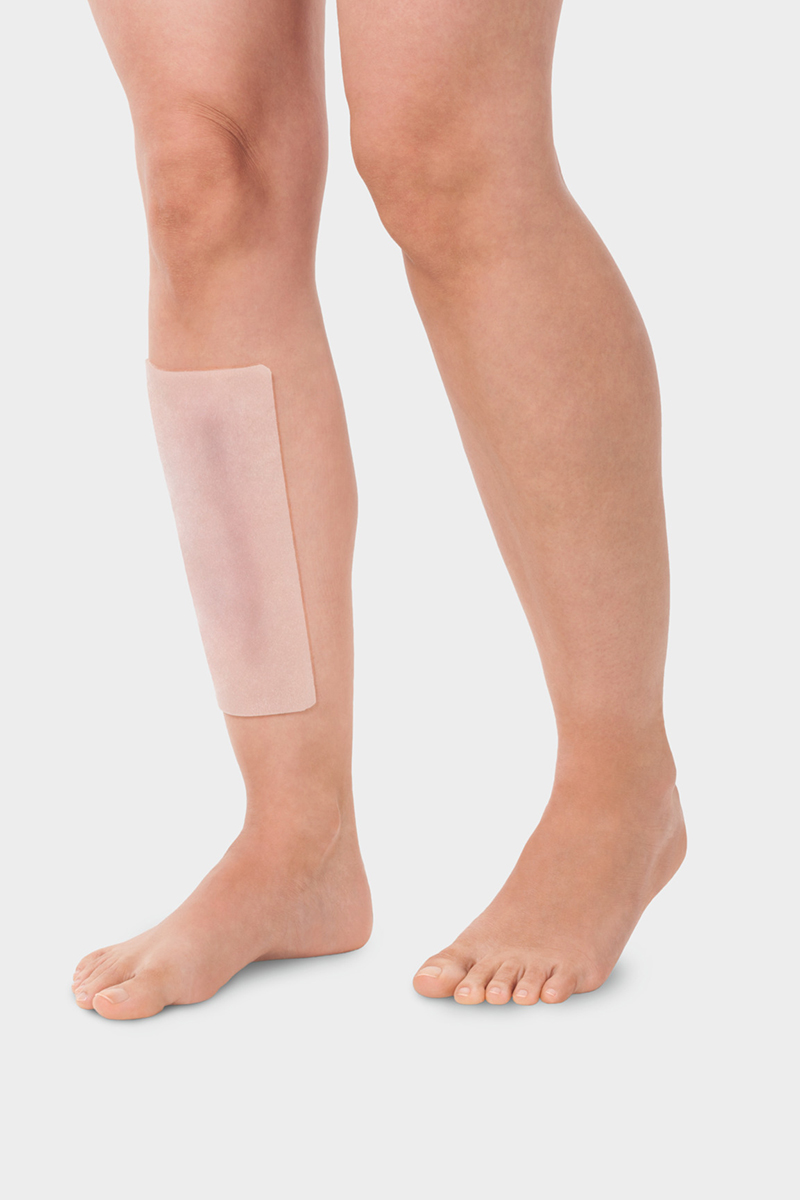 A person is wearing the Juzo ScarPad on their shin to treat a scar A person is wearing the Juzo ScarPad on their shin to treat a scar