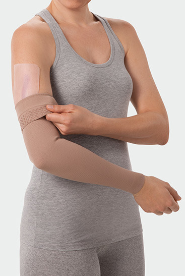 Juzo ScarPad, in combination with compression on the arm Juzo ScarPad, in combination with compression on the arm